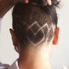 AGAと普通の薄毛の違いを示す頭皮のイメージ画像